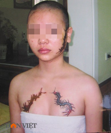 Nguyễn Thị G. bị kẻ độc ác cạo trọc đầu và xăm hình quái vật lên má và hai bên ngực